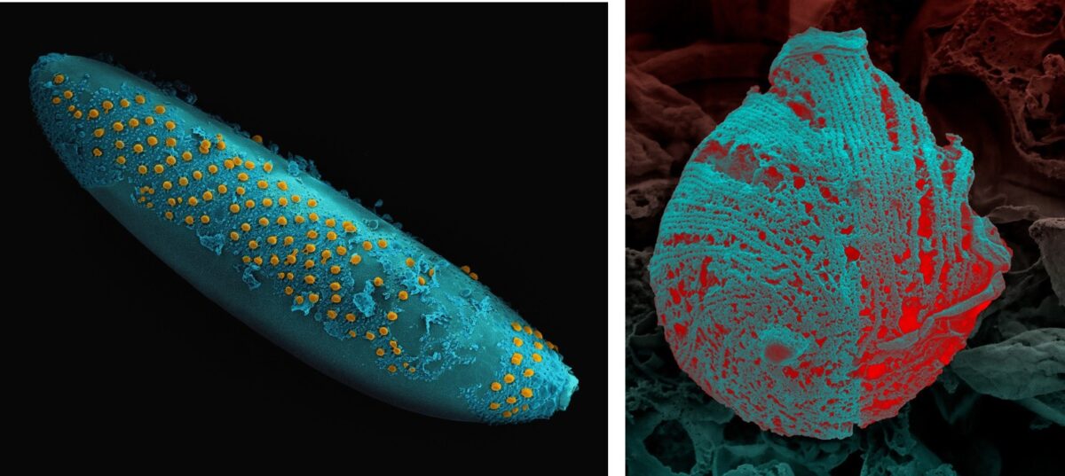 Estudantes do CENABIO estão entre os 25 finalistas do prêmio Wellcome Image Award